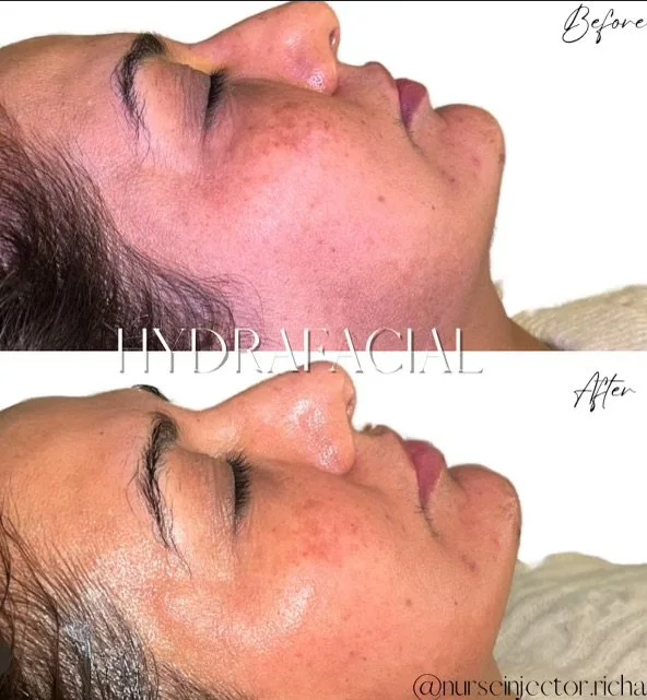 Skincare solutions photograph published by NFMA